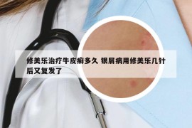 修美樂治療牛皮癬多久 銀屑病用修美樂幾針后又復(fù)發(fā)了