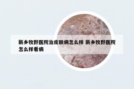 新鄉(xiāng)牧野醫(yī)院治皮膚病怎么樣 新鄉(xiāng)牧野醫(yī)院怎么樣看病