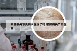 銀屑病關(guān)節(jié)炎納入醫(yī)保了嗎 銀屑病關(guān)節(jié)炎醫(yī)生