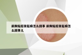 前胸貼后背起癬怎么回事 前胸貼后背起癬怎么回事兒