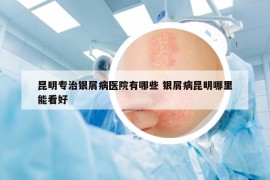 昆明專治銀屑病醫(yī)院有哪些 銀屑病昆明哪里能看好