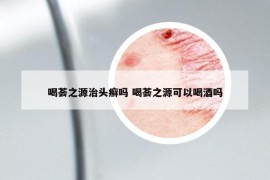 喝薈之源治頭癬嗎 喝薈之源可以喝酒嗎