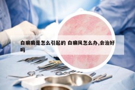 白癩癜是怎么引起的 白癩風(fēng)怎么辦,會(huì)治好嗎