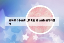 廊坊哪個牛皮癬比較出名 廊坊皮膚病?？漆t(yī)院