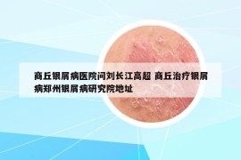 商丘銀屑病醫(yī)院問劉長江高超 商丘治療銀屑病鄭州銀屑病研究院地址