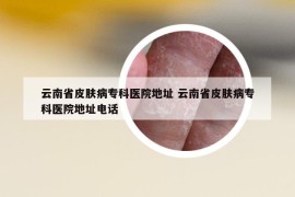 云南省皮膚病?？漆t(yī)院地址 云南省皮膚病?？漆t(yī)院地址電話