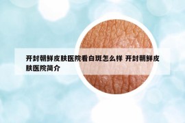 開封朝鮮皮膚醫(yī)院看白斑怎么樣 開封朝鮮皮膚醫(yī)院簡介