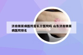 濟(jì)南銀屑病醫(yī)院是私立醫(yī)院嗎 山東濟(jì)南銀屑病醫(yī)院排名