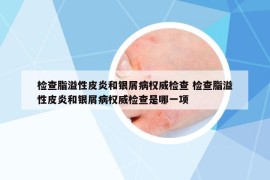 檢查脂溢性皮炎和銀屑病權(quán)威檢查 檢查脂溢性皮炎和銀屑病權(quán)威檢查是哪一項(xiàng)