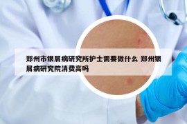 鄭州市銀屑病研究所護(hù)士需要做什么 鄭州銀屑病研究院消費(fèi)高嗎