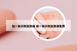 拍一拍識別皮膚病 拍一拍識別皮膚病免費(fèi)