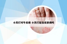 小蘇打?qū)εＦぐ_ 小蘇打能治皮膚病嗎