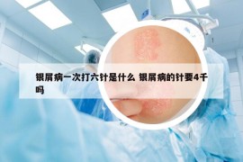 銀屑病一次打六針是什么 銀屑病的針要4千嗎