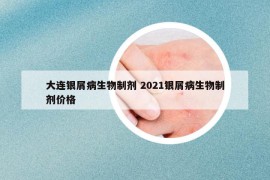 大連銀屑病生物制劑 2021銀屑病生物制劑價格