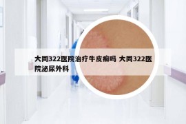 大同322醫(yī)院治療牛皮癬嗎 大同322醫(yī)院泌尿外科