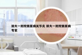鄭大一附院銀屑病關(guān)節(jié)炎 鄭大一附院銀屑病專家