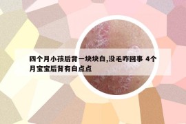 四個(gè)月小孩后背一塊塊白,沒(méi)毛咋回事 4個(gè)月寶寶后背有白點(diǎn)點(diǎn)