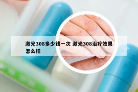 激光308多少錢一次 激光308治療效果怎么樣