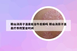 鞍山湯崗子溫泉能治牛皮癬嗎 鞍山湯崗子溫泉療養(yǎng)院營(yíng)業(yè)時(shí)間