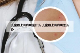 兒童臉上有白斑是什么 兒童臉上有白斑怎么辦