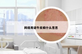 網(wǎng)絡(luò)用語牛皮癬什么意思