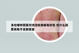 多吃哪種蔬菜對(duì)濃泡皮膚癬有好處 吃什么蔬菜有助于皮膚修復(fù)