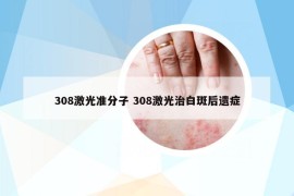 308激光準(zhǔn)分子 308激光治白斑后遺癥