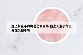 腿上長點小白斑是怎么回事 腿上長點小白斑是怎么回事啊