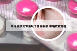 ?，幤つw膏專治玩?zhèn)€性皮癬病 ?，幤つw抑菌