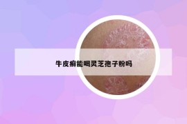 牛皮癬能喝靈芝孢子粉嗎