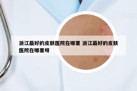 浙江最好的皮膚醫(yī)院在哪里 浙江最好的皮膚醫(yī)院在哪里呀