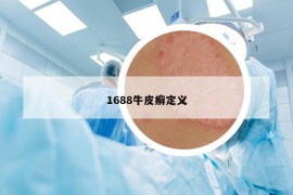 1688牛皮癬定義
