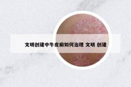 文明創(chuàng)建中牛皮癬如何治理 文明 創(chuàng)建
