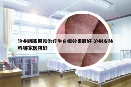 滄州哪家醫(yī)院治療牛皮癬效果最好 滄州皮膚科哪家醫(yī)院好