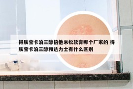 得膚寶卡泊三醇倍他米松軟膏哪個廠家的 得膚寶卡泊三醇和達力士有什么區(qū)別