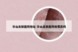 華山皮膚醫(yī)院地址 華山皮膚醫(yī)院收費(fèi)高嗎