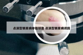 點滴型銀屑病非鏈球菌 點滴型銀屑病誘因
