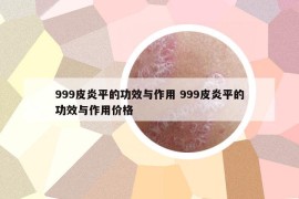 999皮炎平的功效與作用 999皮炎平的功效與作用價(jià)格