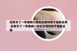后背長了一塊像癬一樣的東西特別干燥而且癢 后背長了一塊像癬一樣的東西特別干燥而且癢