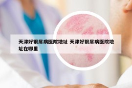 天津好銀屑病醫(yī)院地址 天津好銀屑病醫(yī)院地址在哪里