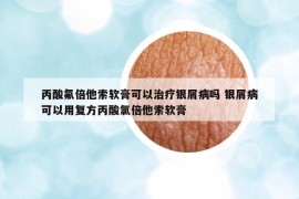 丙酸氟倍他索軟膏可以治療銀屑病嗎 銀屑病可以用復(fù)方丙酸氯倍他索軟膏
