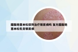 醋酸地塞米松搽劑治療銀屑病嗎 復(fù)方醋酸地塞米松乳膏銀屑病