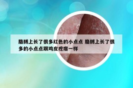 胳膊上長了很多紅色的小點點 胳膊上長了很多的小點點跟雞皮疙瘩一樣