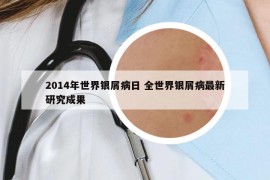 2014年世界銀屑病日 全世界銀屑病最新研究成果