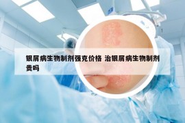 銀屑病生物制劑強克價格 治銀屑病生物制劑貴嗎