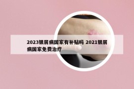 2023銀屑病國(guó)家有補(bǔ)貼嗎 2021銀屑病國(guó)家免費(fèi)治療