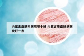 內(nèi)蒙古皮膚科醫(yī)院哪個好 內(nèi)蒙古看皮膚病醫(yī)院好一點