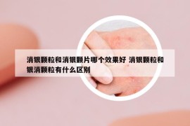消銀顆粒和消銀顆片哪個(gè)效果好 消銀顆粒和銀消顆粒有什么區(qū)別