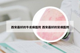西安最好的牛皮癬醫(yī)院 西安最好的腎病醫(yī)院
