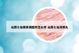山西七仙銀屑病醫(yī)院怎么樣 山西七仙消銀丸